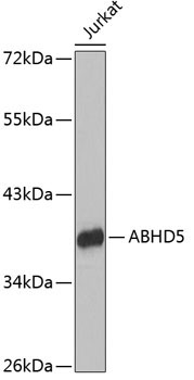 ABHD5 Rabbit Polyclonal Antibody