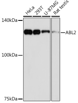 ABL2 Rabbit Monoclonal Antibody