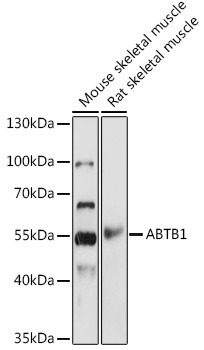 ABTB1 Rabbit Polyclonal Antibody