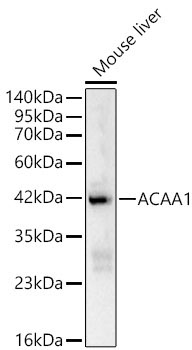 ACAA1 Rabbit Polyclonal Antibody