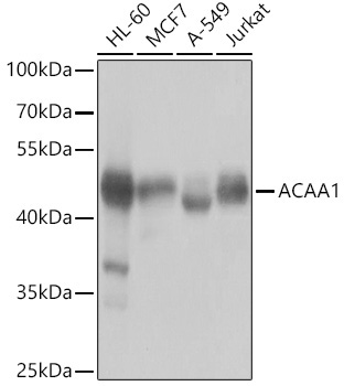 ACAA1 Rabbit Polyclonal Antibody