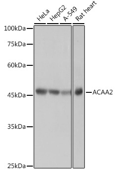 ACAA2 Rabbit Monoclonal Antibody