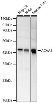 ACAA2 Rabbit Polyclonal Antibody