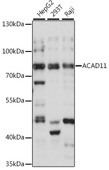 ACAD11 Rabbit Polyclonal Antibody