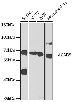ACAD9 Rabbit Polyclonal Antibody