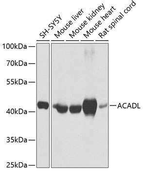 ACADL Rabbit Polyclonal Antibody