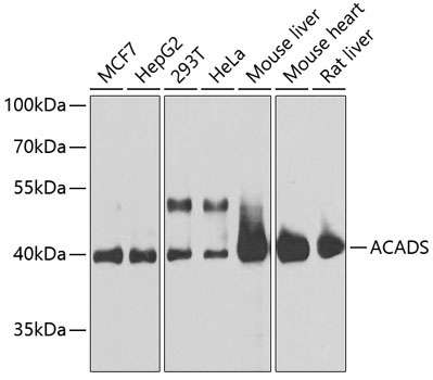 ACADS Rabbit Polyclonal Antibody