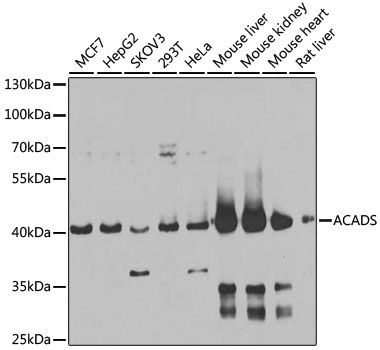 ACADS Rabbit Polyclonal Antibody