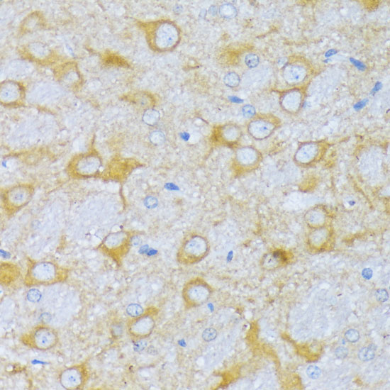 ACADSB Rabbit Polyclonal Antibody