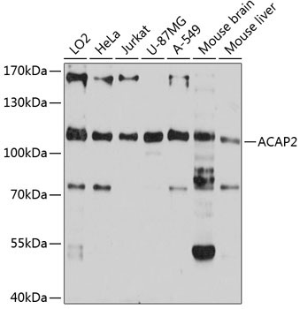 ACAP2 Rabbit Polyclonal Antibody