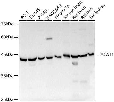 ACAT1 Rabbit Polyclonal Antibody