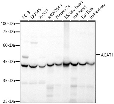 ACAT1 Rabbit Polyclonal Antibody