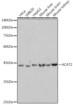 ACAT2 Rabbit Monoclonal Antibody