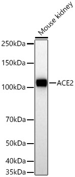 ACE2 Rabbit Monoclonal Antibody