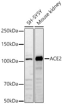 ACE2 Rabbit Polyclonal Antibody