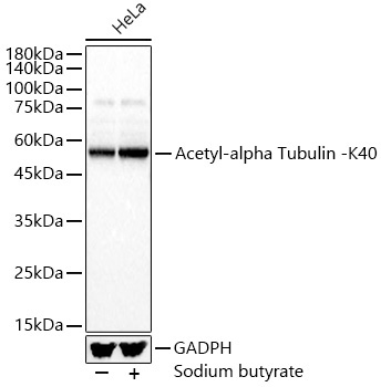Acetyl-alpha Tubulin -K40 Rabbit Polyclonal Antibody