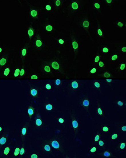 Acetyl-DNMT1-K1127/K1129/K1131/K1133 Rabbit Polyclonal Antibody