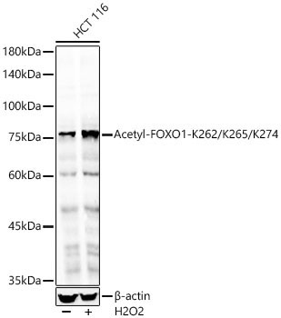 Acetyl-FOXO1-K262/K265/K274 Rabbit Polyclonal Antibody