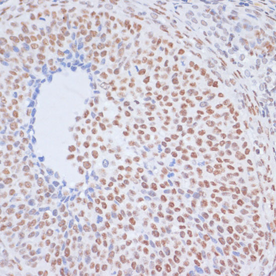 Acetyl-Histone H1.4-K26 Rabbit Polyclonal Antibody