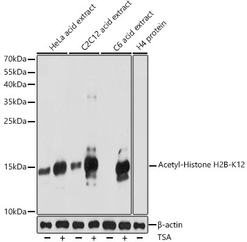 Acetyl-Histone H2B-K12 Rabbit Polyclonal Antibody