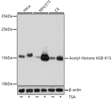 Acetyl-Histone H2B-K15 Rabbit Polyclonal Antibody