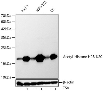 Acetyl-Histone H2B-K20 Rabbit Polyclonal Antibody