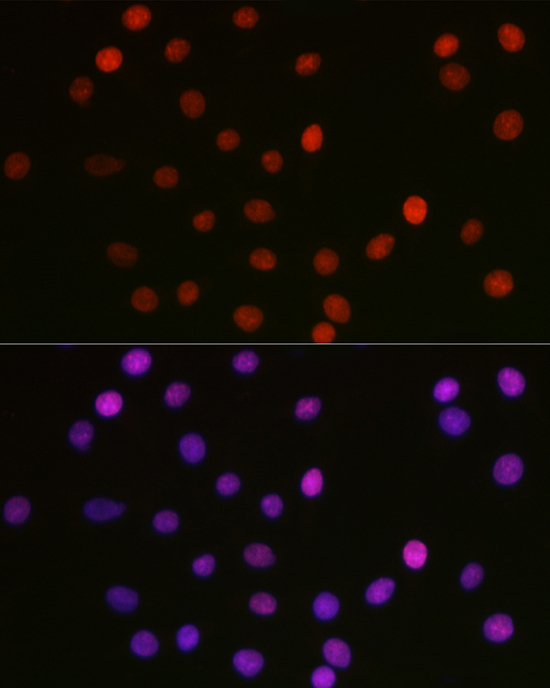 Acetyl-HMGB1-K29 Rabbit Polyclonal Antibody