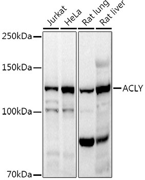 ACLY Rabbit Polyclonal Antibody