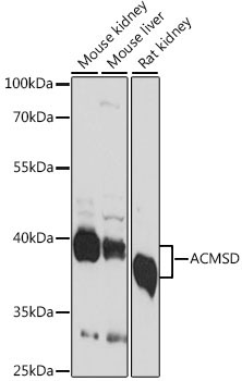 ACMSD Rabbit Polyclonal Antibody