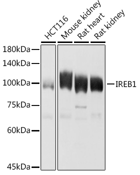 Aconitase 1 (ACO1) Rabbit Polyclonal Antibody