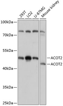 ACOT2 Rabbit Polyclonal Antibody