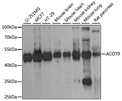 ACOT9 Rabbit Polyclonal Antibody