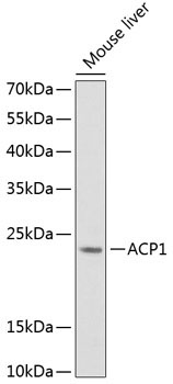 ACP1 Rabbit Polyclonal Antibody