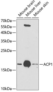 ACP1 Rabbit Polyclonal Antibody