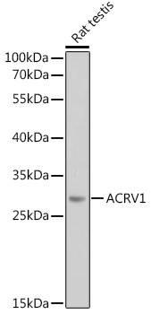 ACRV1 Rabbit Polyclonal Antibody