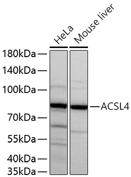 ACSL4 Rabbit Monoclonal Antibody