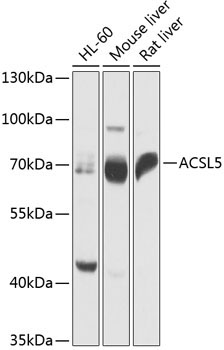 ACSL5 Rabbit Polyclonal Antibody