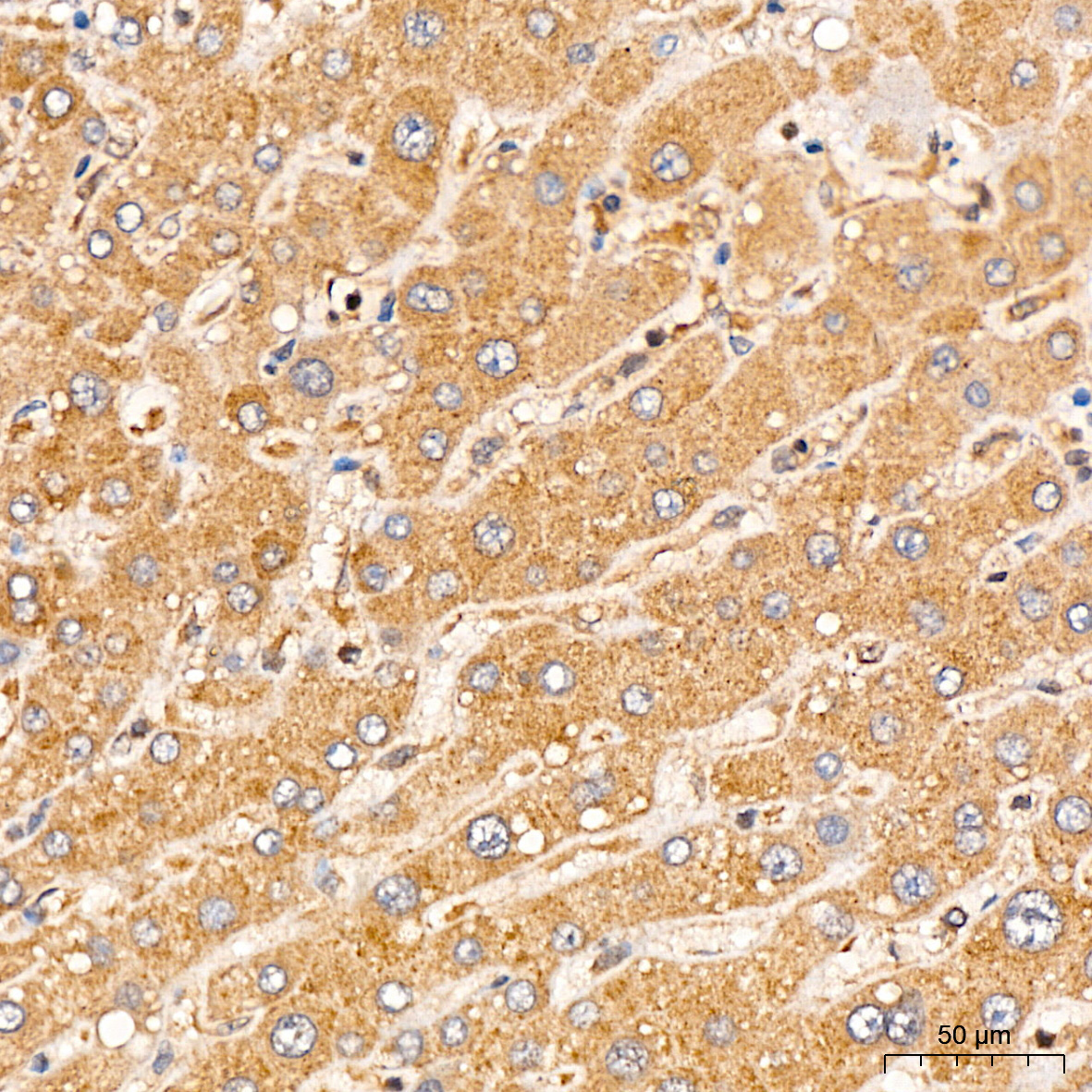 ACSM1 Rabbit Polyclonal Antibody