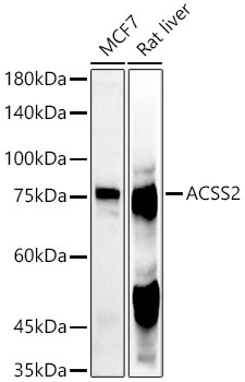ACSS2 Rabbit Polyclonal Antibody