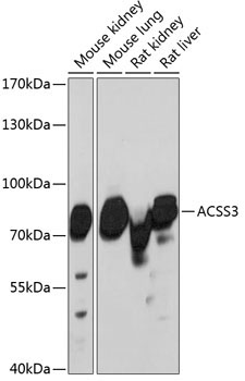 ACSS3 Rabbit Polyclonal Antibody