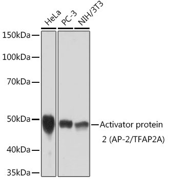 Activator protein 2 (AP-2/TFAP2A) Rabbit Monoclonal Antibody