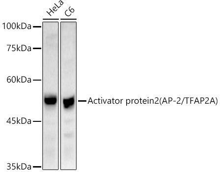 Activator protein 2 (AP-2/TFAP2A) Rabbit Polyclonal Antibody