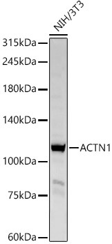 ACTN1 Rabbit Polyclonal Antibody