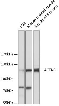 ACTN3 Rabbit Polyclonal Antibody