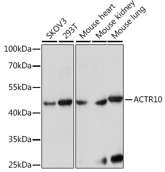 ACTR10 Rabbit Polyclonal Antibody