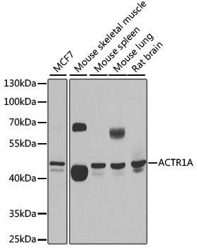 ACTR1A Rabbit Polyclonal Antibody