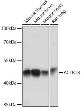 ACTR1B Rabbit Polyclonal Antibody