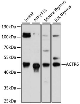 ACTR6 Rabbit Polyclonal Antibody