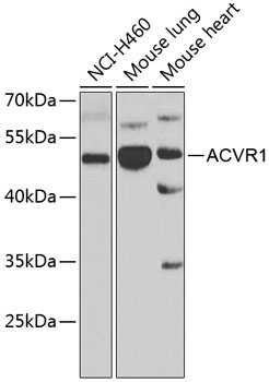 ACVR1 Rabbit Polyclonal Antibody