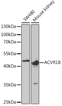 ACVR1B Rabbit Polyclonal Antibody
